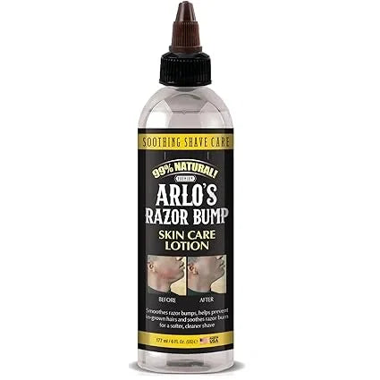 Arlo's Razor Bump Skin Care Lotion 6 oz. — CLIPRONS